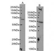Western blot testing of A) mouse brain and B) mouse testis lysate with Choline acetyltransferase antibody at 0.1ug/ml. Predicted molecular weight ~74 kDa.