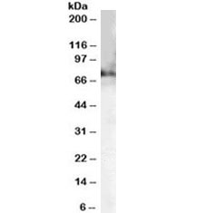 Western blot testing of mouse brain lysate with Choline acetyltransferase antibody at 0.2ug/ml. Predicted molecular weight ~73kDa.