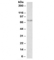 Western blot testing of mouse small intestine lysate with SLC6A4 antibody at 0.5ug/ml. Expected molecular weight: ~70/85-95kDa (unmodified/glycosylated).