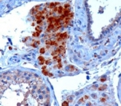 IHC staining of FFPE human testis with SECISBP2 antibody at 3ug/ml. HIER: microwaved with pH9 Tris/EDTA buffer, HRP-staining.