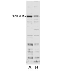 Western blot testing of HFF cell lysate and A) control siRNA or B) 100nM siRNA with SECISBP2 antibody at 0.2ug/ml.~