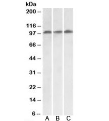 Western blot testing of HeLa [A], HepG2 [B] and Jurkat [C] lysates with VPS16 antibody at 0.1ug/ml. Predicted molecular weight: ~95kDa (isoform 1).~