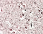IHC staining of FFPE human cerebral cortex with GRM2 antibody at 4ug/ml. HIER: steamed with pH6 citrate buffer, AP-staining. Membranous and axonal staining is seen.
