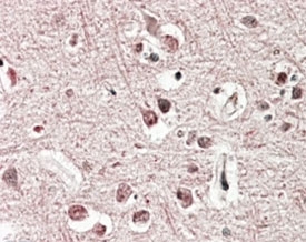 IHC staining of FFPE human cerebral cortex with GRM2 antibody at 4ug/ml. HIER: steamed with pH6 citrate buffer, AP-stai