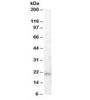 Western blot testing of human pancreas lysate with ARMET antibody at 0.3ug/ml. Predicted molecular weight: ~21kDa.