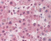 IHC testing of FFPE human liver tissue with Pyruvate Caboxylase antibody at 5ug/ml. HIER: steamed antigen retrieval with pH6 citrate buffer; AP-staining.