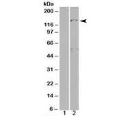Western blot of HEK293 lysate overexpressing human Pyruvate Carboxylase probed with Pyruvate Carboxylase antibody (mock transfection in lane 1). Predicted molecular weight: ~130 kDa, observed here at 140~150 kDa.