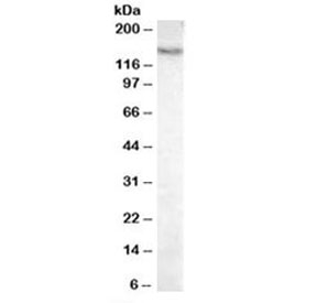 Western blot testing of mouse liver lysate with Pyruvate Carboxylase antibody at 0.03ug/ml. Predicted molecular weight: ~130kDa, observed here at 140~150kDa.