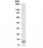 Western blot testing of human lung lysate with S100A8 antibody at 0.03ug/ml. Predicted molecular weight ~11kDa.