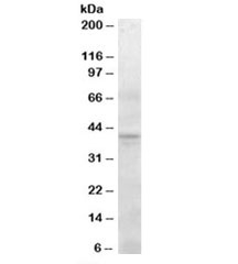 Western blot testing of human pancreas lysate with SERPINI2 antibody at 0.3ug/ml. Predicted molecular weight: ~46kDa, observed here at ~40kDa.~