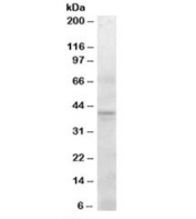 Western blot testing of human pancreas lysate with SERPINI2 antibody at 0.3ug/ml. Predicted molecular weight: ~46kDa, observed here at ~40kDa.