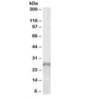 Western blot testing of human adrenal gland lysate with PHOX2A antibody at 1ug/ml. Predicted molecular weight: ~30kDa.