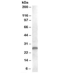 Western blot testing of human kidney lysate with CLEC1B antibody at 1ug/ml. Predicted molecular weight: ~27kDa.