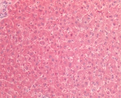 IHC testing of FFPE human liver tissue with TNFR2 antibody at 5ug/ml. HIER: steam section in pH6 citrate buffer for 20 min and allow to cool prior to staining.