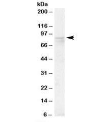 Western blot testing of human placenta lysate with OSBP antibody at 0.1ug/ml. Predicted molecular weight: ~89kDa.