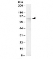 Western blot testing of human placenta lysate with OSBP antibody at 0.1ug/ml. Predicted molecular weight: ~89kDa.