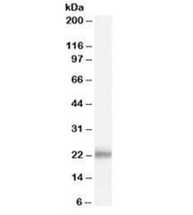 Western blot testing of human prostate lysate with KLK2 antibody at 0.1ug/ml. Predicted molecular weight: ~25kDa.~