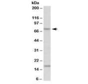 Western blot testing of mouse kidney lysate with TGM7 antibody at 0.1ug/ml. The expected ~75 kDa band and additional ~17 kDa band are both blocked by the immunizing peptide.