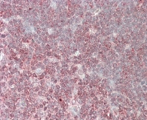 IHC staining of FFPE human thymus with CrkL antibody at 4ug/ml. HIER: steamed with pH6 citrate buffer, AP-staining.