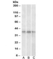 Western blot testing of A) Daudi, B) Jurkat whole and C) Jurkat nuclear lysates with PHF11 antibody at 1ug/ml. Predicted/observed molecular weight: ~37kDa.