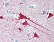 IHC staining of FFPE human cortex with Neurogranin antibody at 4ug/ml. HIER: steamed with pH6 citrate buffer, AP-staining.