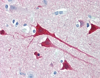 IHC staining of FFPE human cortex with Neurogranin antibody at 4u