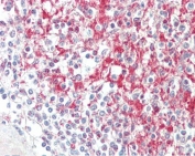 IHC testing of FFPE human spleen tissue with ADAM19 antibody at 5ug/ml. Required HIER: steamed antigen retrieval with pH6 citrate buffer; AP-staining.