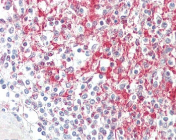 IHC testing of FFPE human spleen tissue with ADAM19 antibody at 5ug/ml. Required HIER: steamed