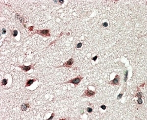 IHC staining of FFPE human cerebral cortex with DYX1C1 antibody at 5ug/ml. HIER: steamed with pH6 citrate buffer, AP-staining.~