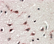 IHC staining of FFPE human cerebral cortex with DYX1C1 antibody at 5ug/ml. HIER: steamed with pH6 citrate buffer, AP-staining.