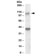 Western blot testing of rat brain lysate with GRIK3 antibody at 0.3ug/ml. The expected ~110kDa band and additional ~39kDa band are both blocked by the immunizing peptide.