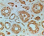 IHC testing of FFPE human kidney with FZD4 antibody at 2ug/ml. HIER: steamed with pH6 citrate buffer, HRP-staining.