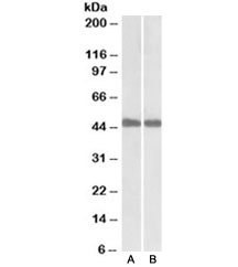 Western bot of mouse (A) and rat (B) liver lysates with IDH1 antibody at 0.1ug/ml. Predicted molecular weight ~46 kDa.