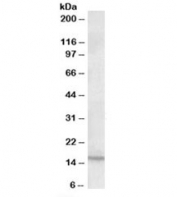 Western blot testing of human duodenum lysate with CXCL2 antibody at 0.2ug/ml. Predicted molecular weight: ~12kDa.