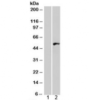 Western blot of HEK293 lysate overexpressing WIPF1 probed with WIPF1 antibody (mock transfection in lane 1). Commonly observed molecular weight: 50-55 kDa with a possible ~36 kDa isoform.