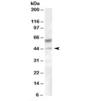 Western blot of human liver lysate with DGAT2 antibody at 0.5ug/ml. Predicted molecular weight: ~44kDa.
