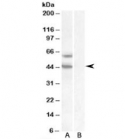 Western blot of HEK293 lysate overexpressing DGAT2 probed with DGAT2 antibody (mock transfection in right lane). Predicted molecular weight: ~44kDa.