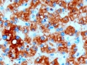 IHC testing of FFPE human liver with DGAT2 antibody at 3ug/ml. HIER: microwave with pH9 Tris/EDTA buffer, HRP-staining.