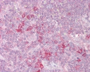 IHC testing of FFPE human thymus tissue with MASK antibody at 2.5ug/ml. Required HIER: steamed antigen retrieval with pH6 citrate buffer; AP-staining.