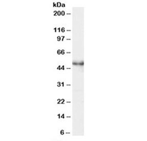 Western blot testing of Jurkat lysate with MASK antibody at 0.5ug/ml. Predicted molecular weight: ~47kDa.~