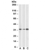 Western blot testing of human [A], mouse [B] and rat [C] brain lysate with EB3 antibody at 0.1ug/ml. Predicted molecular weight: ~32kDa.