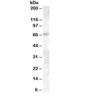 Western blot testing of A431 lysate with ABCE1 antibody at 0.3ug/ml. Predicted molecular weight: ~68kDa.