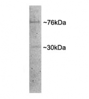 Western blot testing of porcine MII oocyte lysate with Dishevelled antibody at 1ug/ml. Predicted molecular weight: ~76kDa.