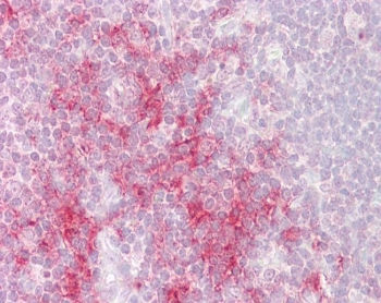 IHC testing of FFPE human thymus tissue with TRAF1 antibody at 2.5ug/ml. Required HIER: steamed antigen retrieval with pH6 citrate buffer; AP-staining.