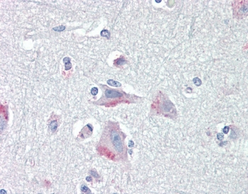 IHC testing of FFPE human cortex (brain) tissue with CRF1 antibody at 5ug/ml. Required HIER: steamed antigen retrieval with pH6 citrate buffer; AP-staining.