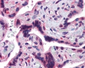IHC staining of FFPE human placenta with TRAF2 antibody at 3.8ug/ml. HIER: steamed with pH6 citrate buffer, AP-staining.