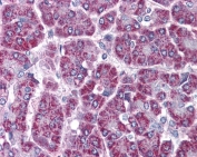 IHC staining of FFPE human pancreas with TRAF2 antibody at 3.8ug/ml. HIER: steamed with pH6 citrate buffer, AP-staining.