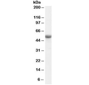 Western blot testing of human ovay lysate with TRAF2 antibody at 0.1ug/ml. Predicted molecular weight: ~55kDa.