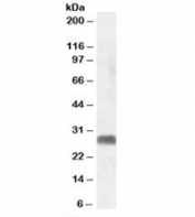 Western blot testing of human testis lysate with SRD5A2 antibody at 1ug/ml. Predicted molecular weight: ~28kDa.