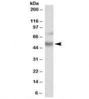 Western blot testing of human hippocampus lysate with ULK3 antibody at 1ug/ml. Predicted molecular weight: ~53kDa. Both observed bands are blocked by addition of immunizing peptide.
